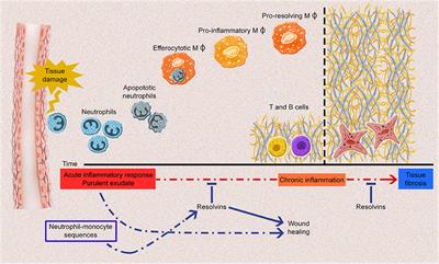 The Role of Endogenous Eicosapentaenoic Acid and Docosahexaenoic Acid-Derived Resolvins in Systemic Sclerosis